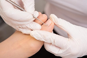 What Is a Medical Pedicure and Why Should You Get One