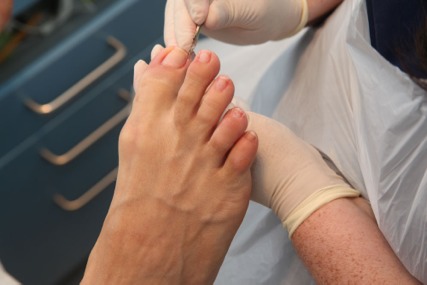 What Does a Chiropodist Do?