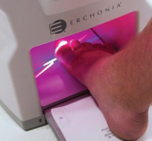 Pink laser in Lunula Laser Machine at Beauchump Foot Care