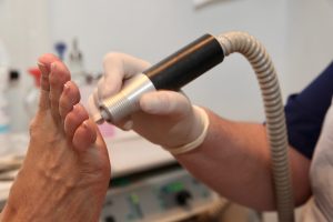 Podiatrist removing hard skin from patiemt's foot